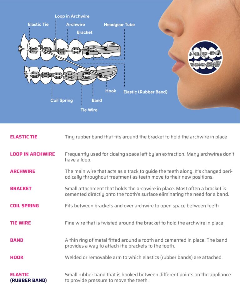 Braces in Draper, Utah Watson Orthodontics